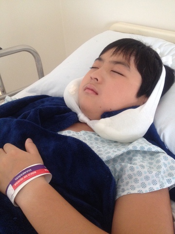 Alexandro - Tirando dente do siso