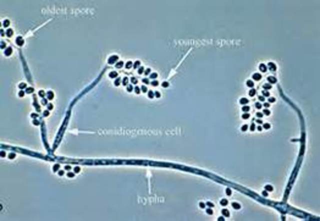 Beauvaria Bassiana Discovered To Cause Thrush