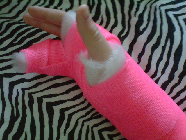 Dora broke her right arm