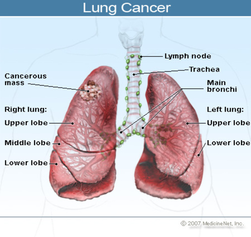 family relative starts smoking aain