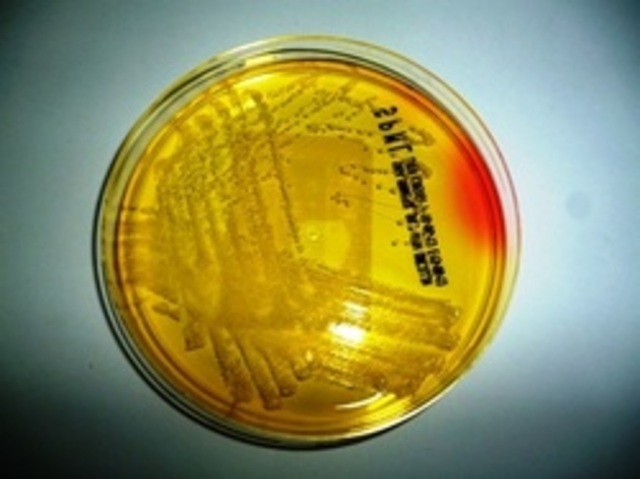 Discovery of MRSA