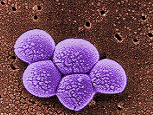 Founding of MRSA through Staph