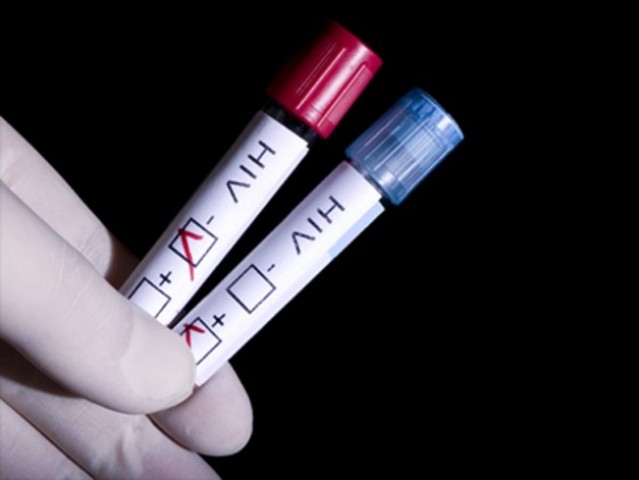 FDA Approval of First HIV Test
