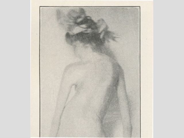 First U.S case of Polio