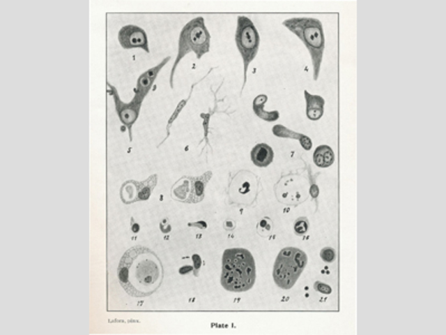 Polio pathogen identified
