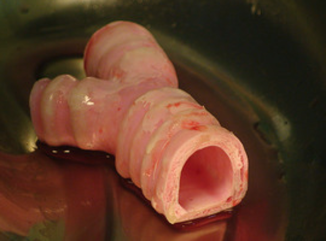 Primeiro orgão artificial