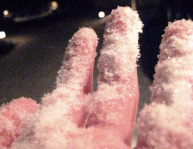 journal 20 it hurts, and not so much anymore?