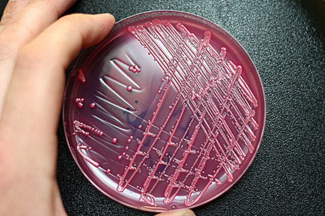 Robert Koch Begins discovery of the Connection between Bacteria and Disease