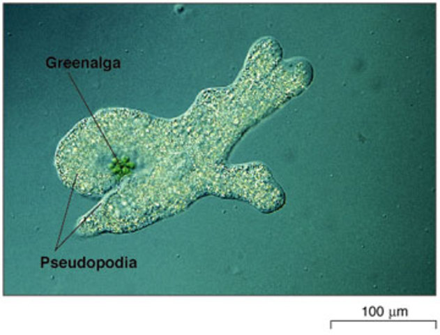 First to Observe Bacreria and Protozoa