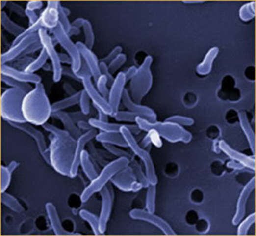 Rudolf Emmerich and Oscar Low