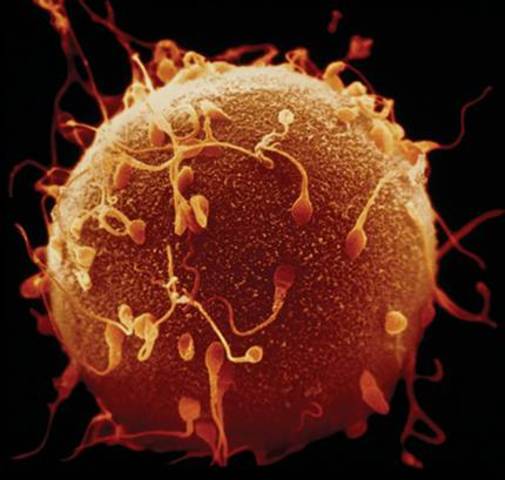 Albrecht von Roelliker