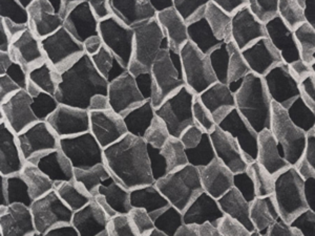 cells were first seen