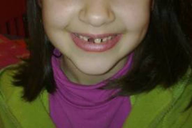 VISITA DEL RATÓN PÉREZ