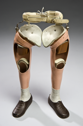 Extension Prosthetics