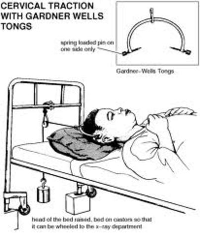 Lesión en el cuello