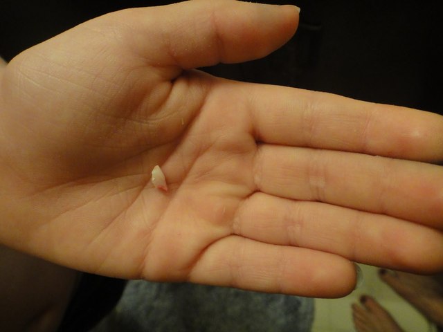 when i lost my first tooth.