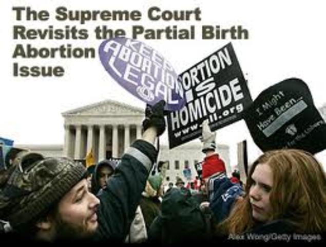 Partial-Birth Abortion Ban Act