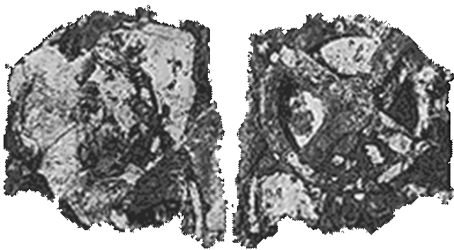 Μηχανισμός Αντικυθήρων