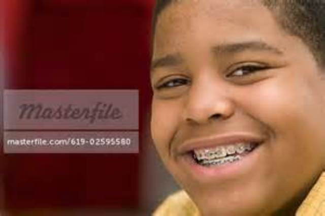 El día que tengo brackets