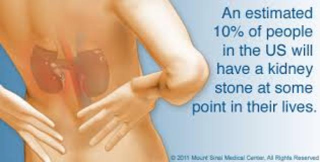 Mi primero la pidera a la rinon