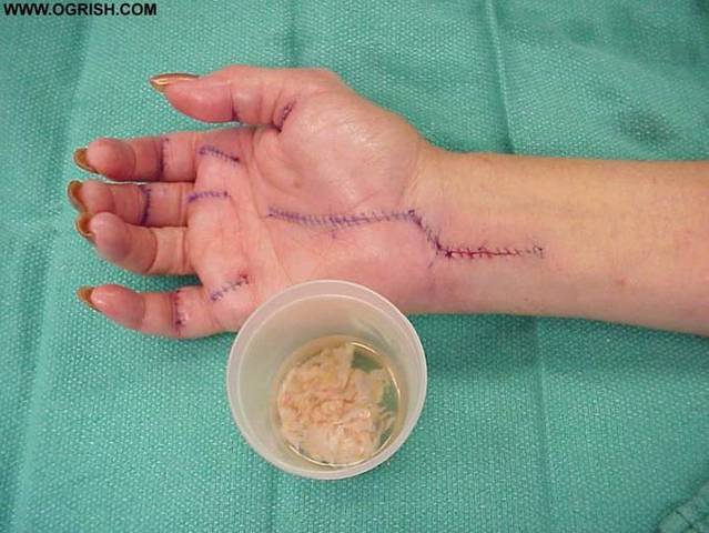 Copernicus had basically completed his work on the manuscript of De revolutionibus orbium coelestium