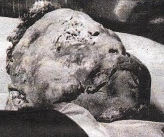 emmit till shot and beaten