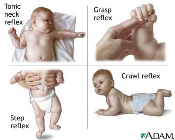 Newborn reflexes