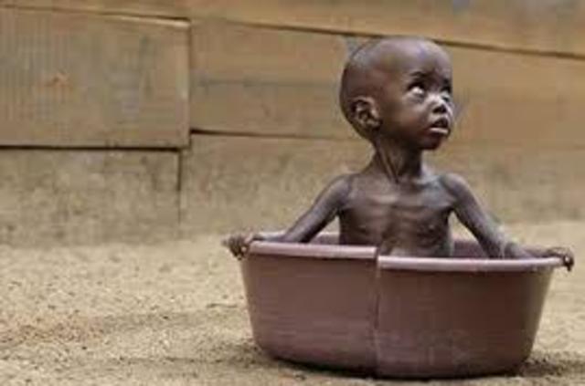 Underweight children