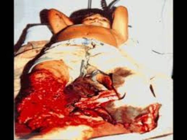 minas antipersonales