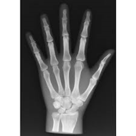 X-rays were discovered by a German Physicist