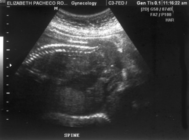 Unexplained Phenomenon