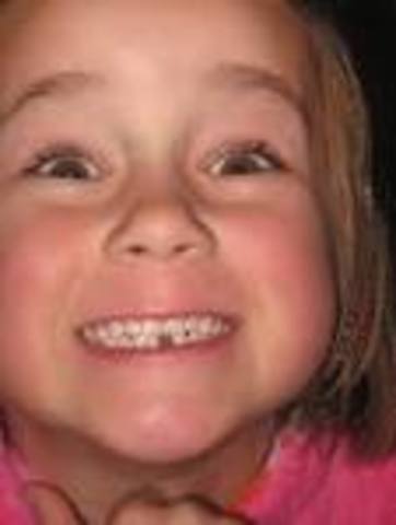 my first lost tooth