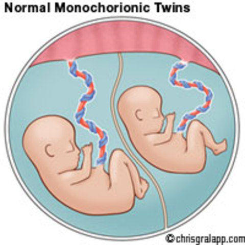Do twnins share an umbilical cord ?