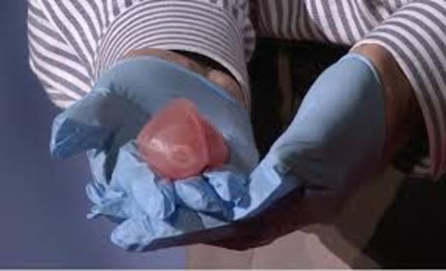 a 3d printed working kidney is created