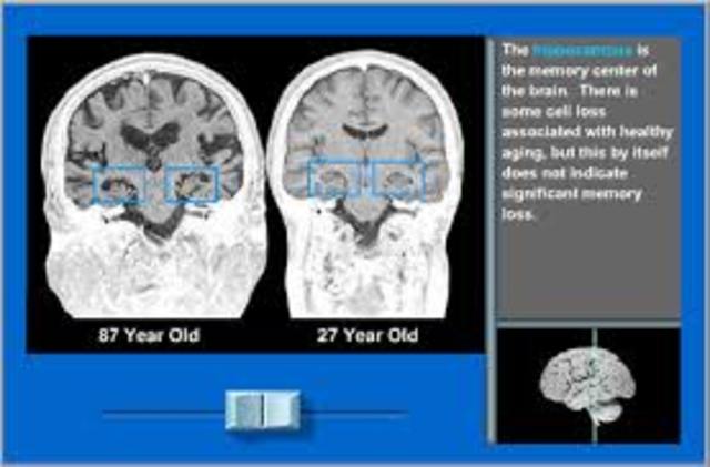 Late Adulthood: Cognitive Development: The Brain