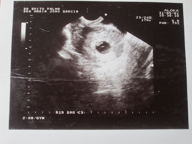 A Minha Primeira Imagem