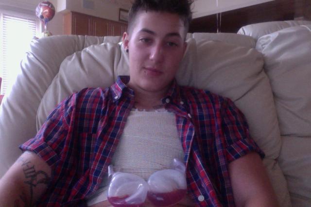 Surgery: Ro Walker Mills