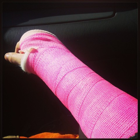 Yo rompí mi muñeca