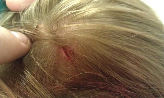 Mi primer año de la escuela secundaria me quebró la cabeza abierta en el escaparate equipo de baile.