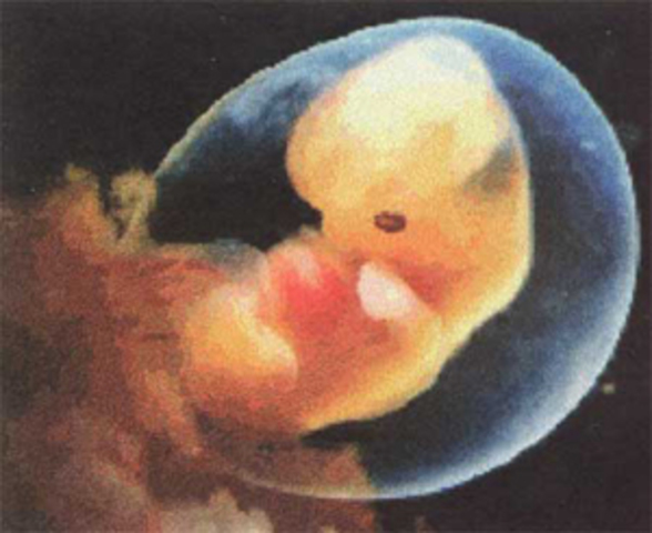 Embryo