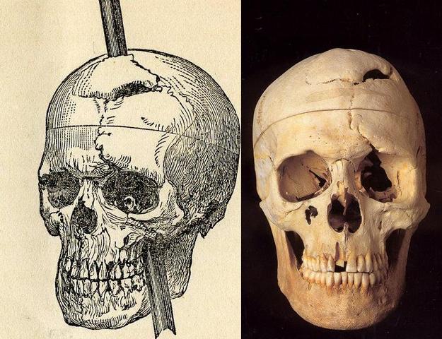 Phineas Gage suffers brain damage- area of brain correlated to personality