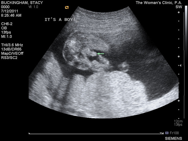 Little baby Andromeda