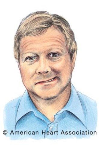 Mohammad first stroke.