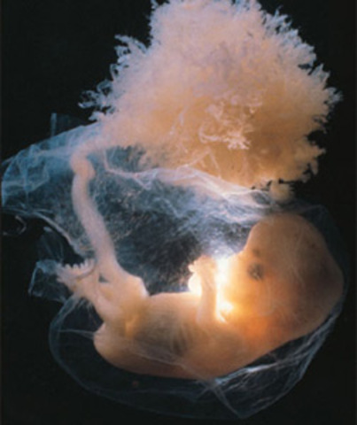 Band of Federally Funded Fetal Tissue Research