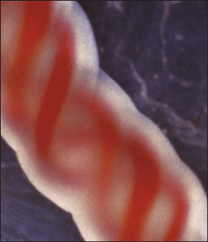 Cells found in Human Cord Blood