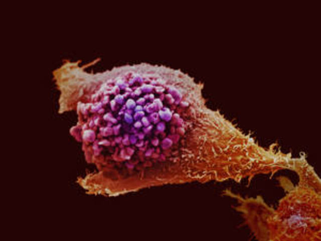 Cancer Stem Cell