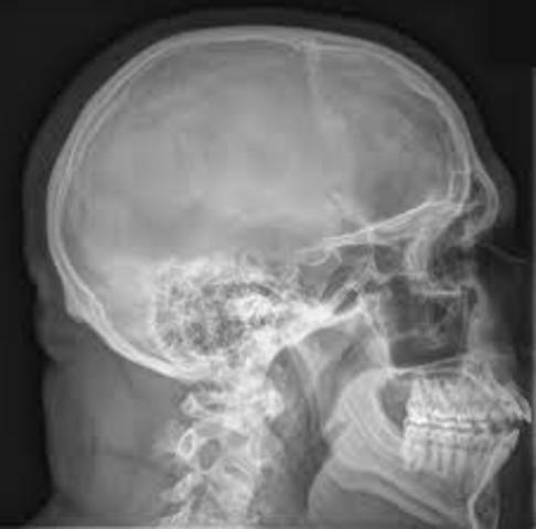 Wilhelm Conrad Röntgen avastab x-kiired