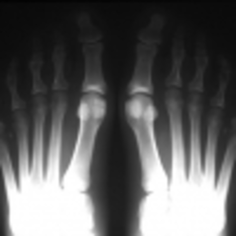 W. C. Röntgen avastab x-kiired