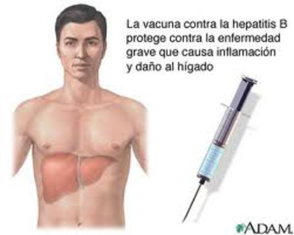 Hepatitis B