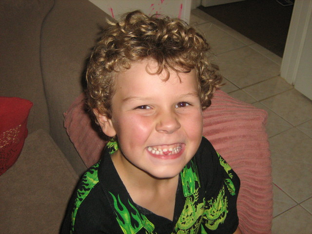 First Tooth Lost